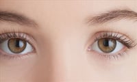 Home remedies for your beautiful eyes? 